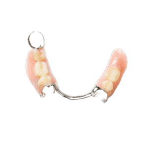 Cobalt Chrome Dentures - toofus™ Dental