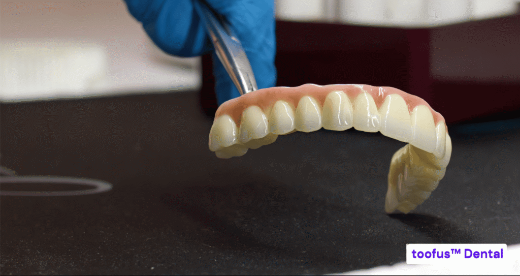 You Should Probably Not Rush Into Dental Implants: 10 Reasons Why 3 Temporary dentures may be used before dental implant treatment – toofus™ Dental