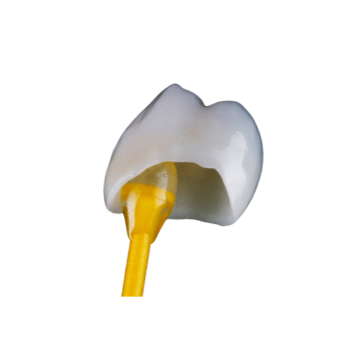 Dental Crown - toofus™ Dental
