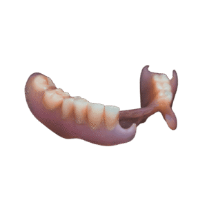 Flexible Dentures - toofus™ Dental