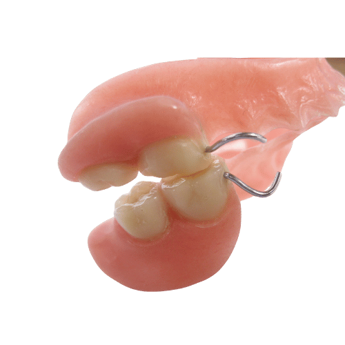 Partial Dentures - toofus™ Dental