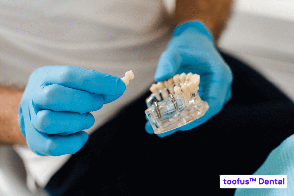 Dental implant and crown model showing the components included in dental implant costs – toofus™ Dental