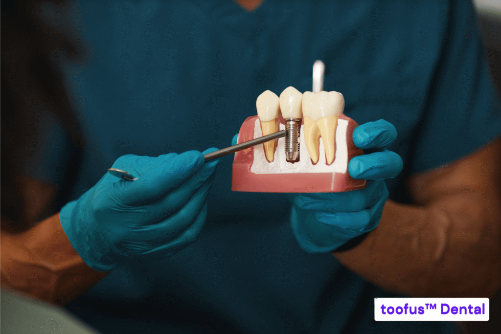 Dentist demonstrating a dental implant model – toofus™ Dental