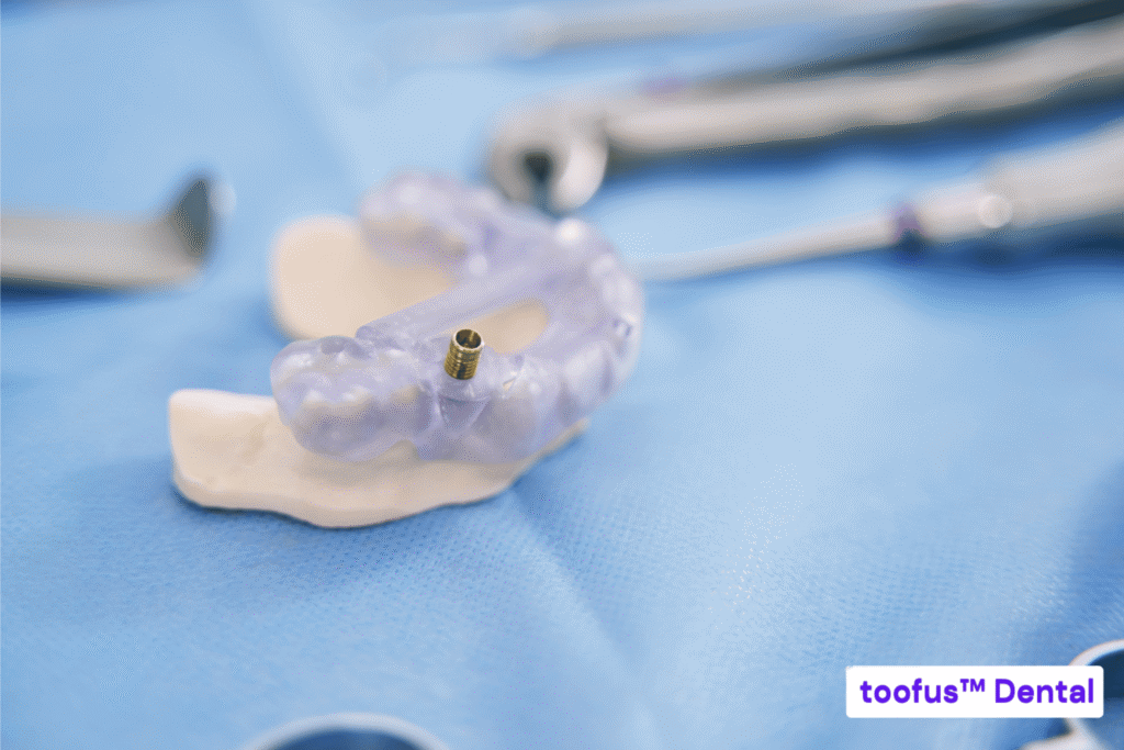 Are All-On-X Dental Implants Painful? 2 Surgical guide used for All-on-X dental implant placement – toofus™ Dental