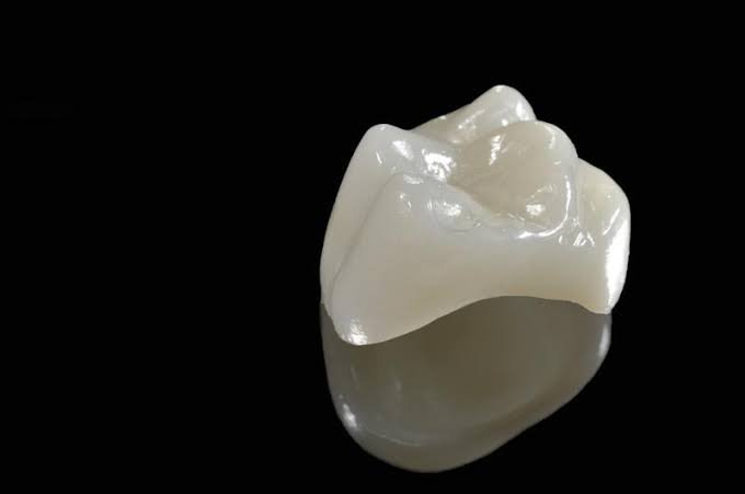 Dental Crowns 1 Molar Dental Crown - toofus™ Dental