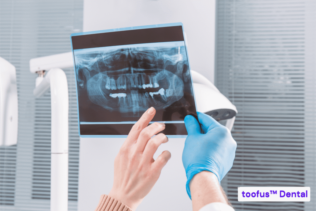 What Will Happen At Your First Dental Implant Consultation 2 Dentist pointing at a dental x-ray - toofus™ Dental