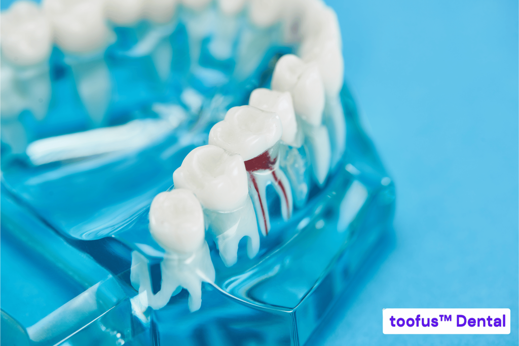 Can I Use Flexi-Medisave For My Root Canal Treatment and Dental Crown? 2 Flexi-Medisave can be used for root canal treatments - toofus™ Dental