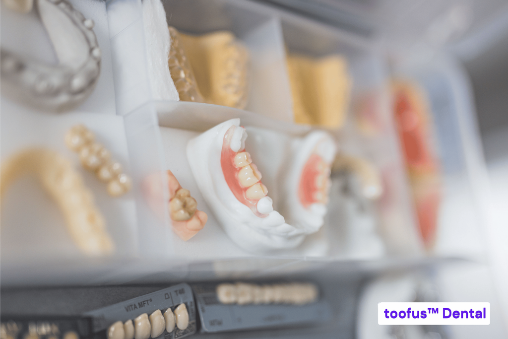 5 Questions to Ask Before Committing To Dentures 2 Various types of dental prosthesis in a lab – toofus™ Dental
